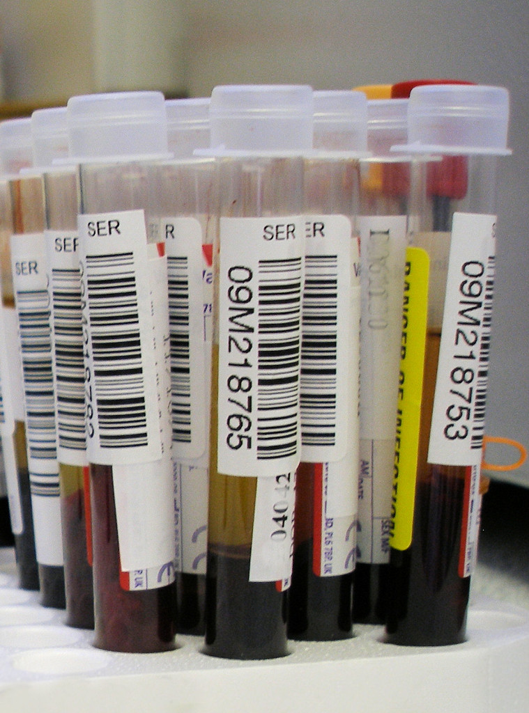 Blood test